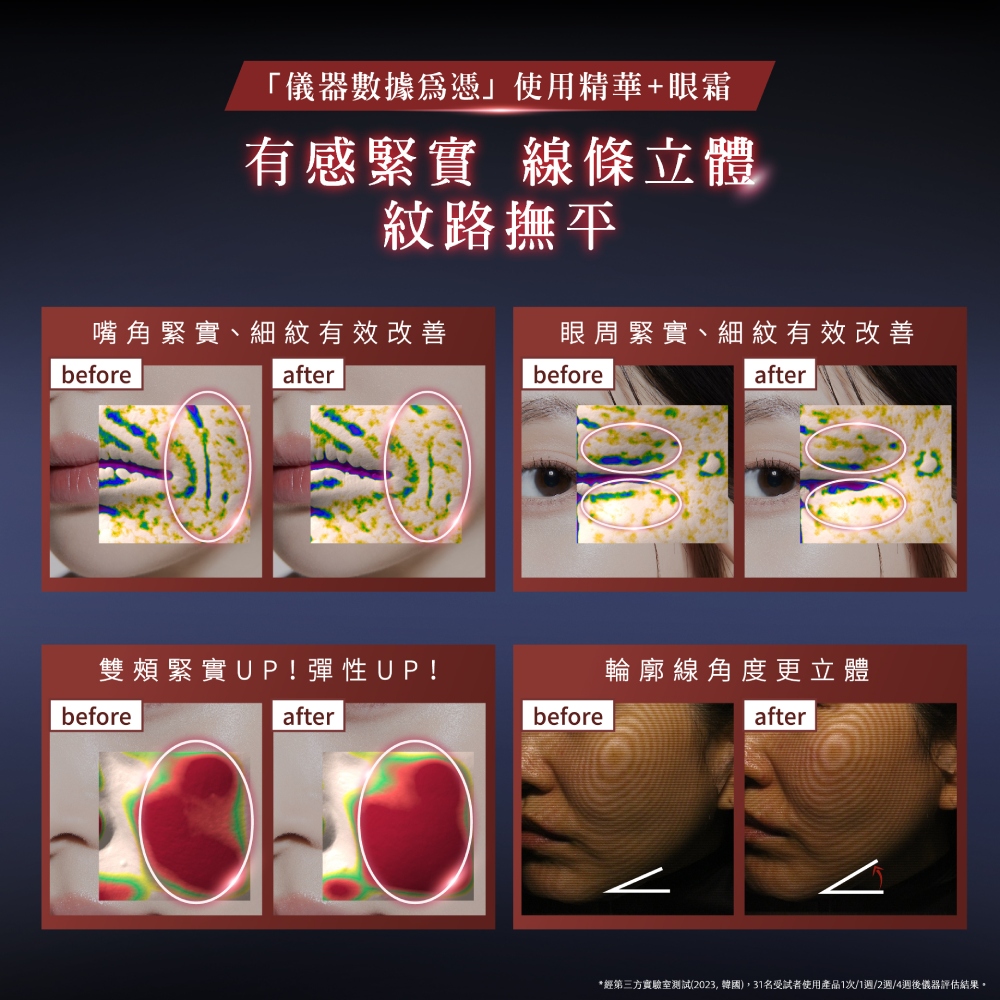 经第三方实验室测试2023,韩国,31名受试者使用产品1次1周2周4周后仪器评估结果。
