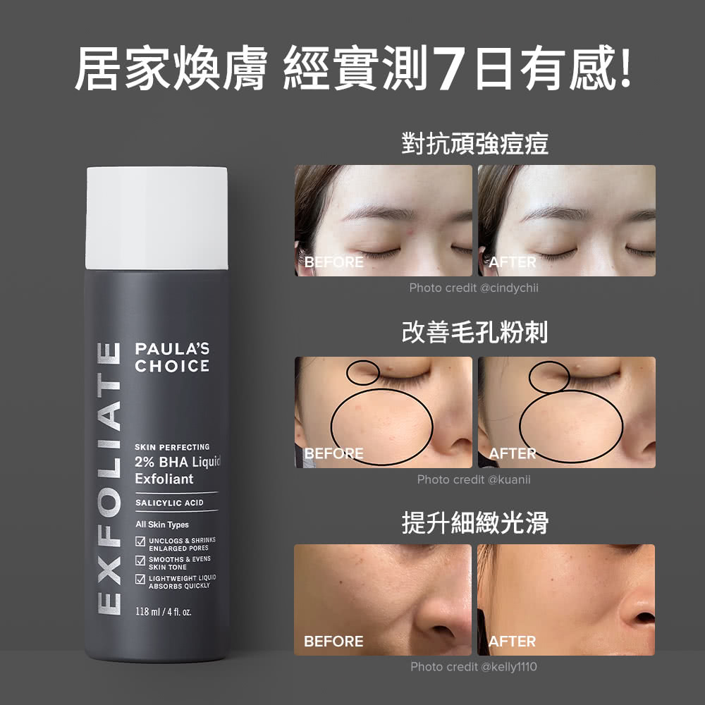 居家焕肤 经实测7日有感 对抗顽强痘痘 改善毛孔粉刺 提升细致光滑